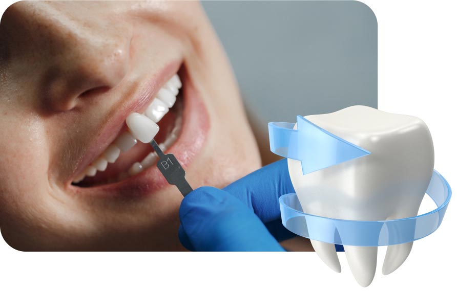 Dental Treatment