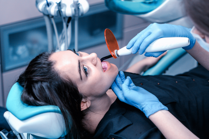 Dental fillings