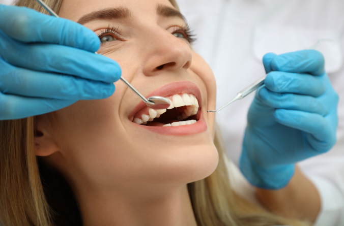 dental fillings
